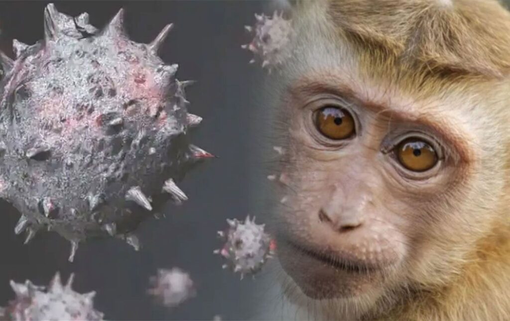 Maymun Çiçeği Virüsü Nedir-Maymun Çiçeği Virüsü Belirtileri ve Tedavi yöntemi