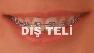 Diş Teli Tedavisi ve Dikkat Edilmesi Gerekenler Nelerdir?